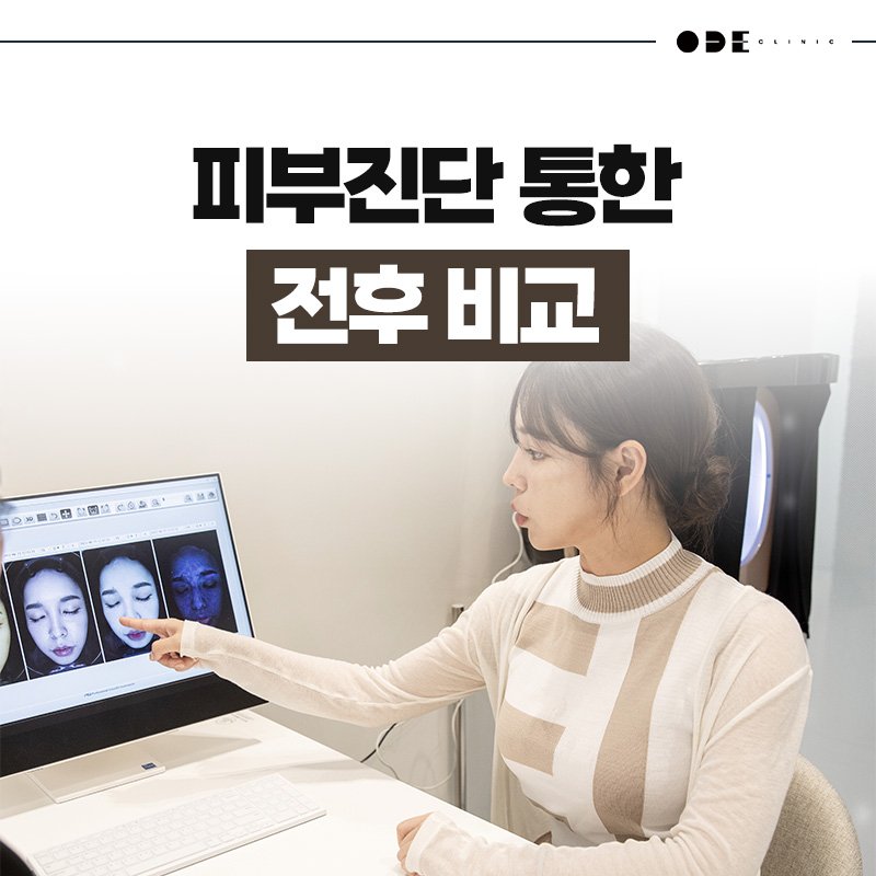aesthetic clinic Seoul