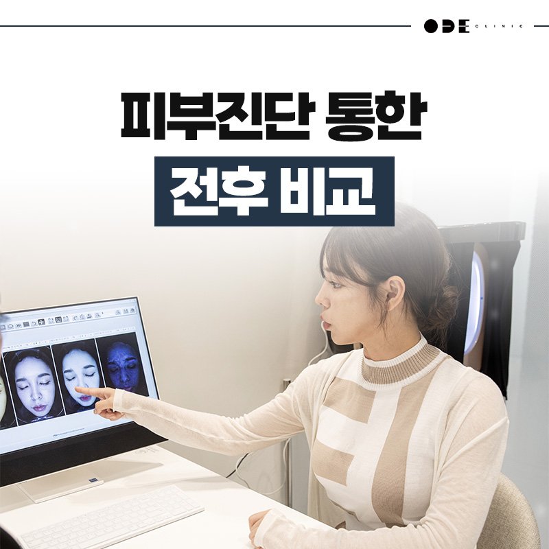 XERF treatment Gangnam